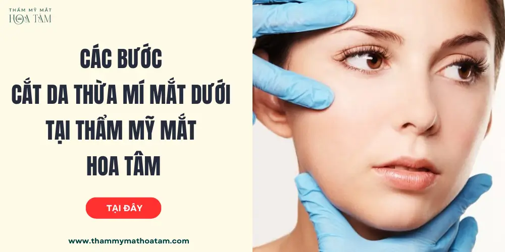 Quy trình cắt da thừa mí mắt dưới tại Thẩm Mỹ Mắt Hoa Tâm