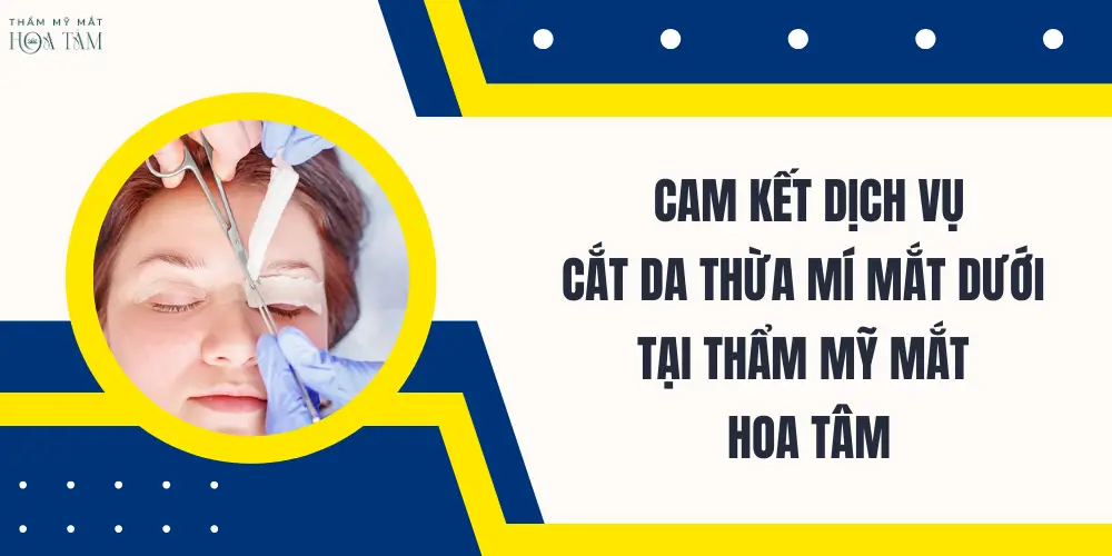 Cam kết dịch vụ cắt da dư mí mắt dưới