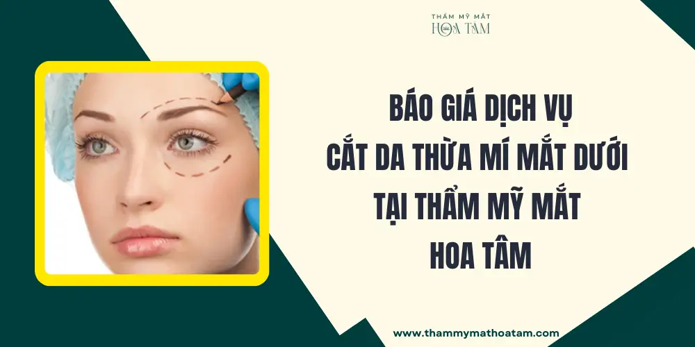 Chi phí phẫu thuật cắt da thừa mí mắt dưới tại Hoa Tâm