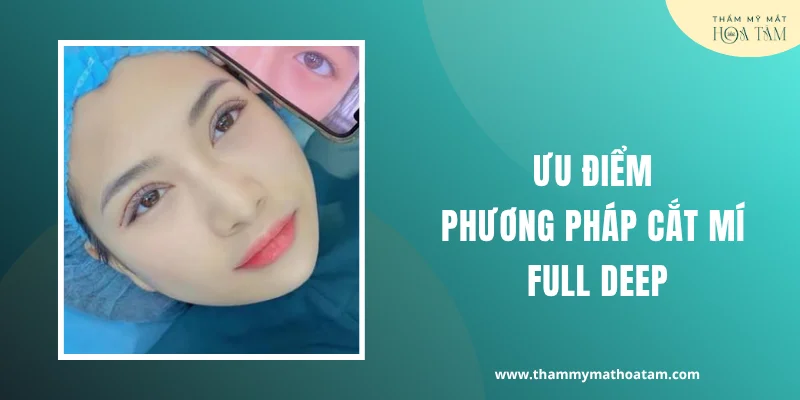 Ưu điểm phương pháp cắt mí full deep Ưu điểm phương pháp cắt mí full deep