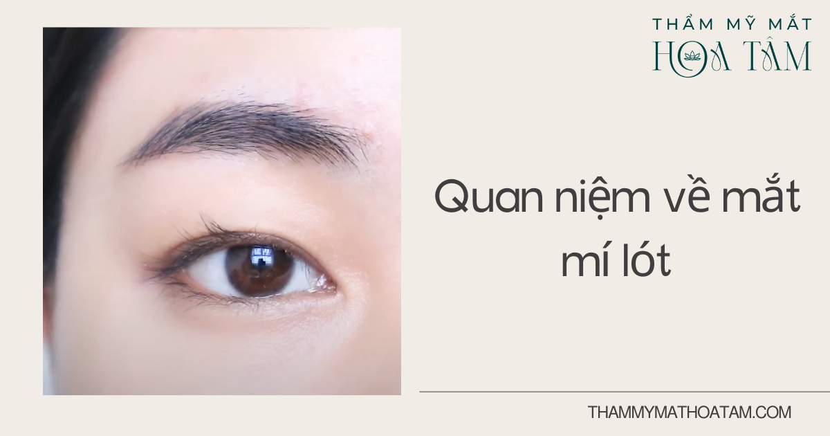 Tìm hiểu quan niệm về mắt mí lót
