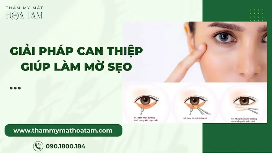 Giải pháp can thiệp y khoa giúp làm mờ sẹo