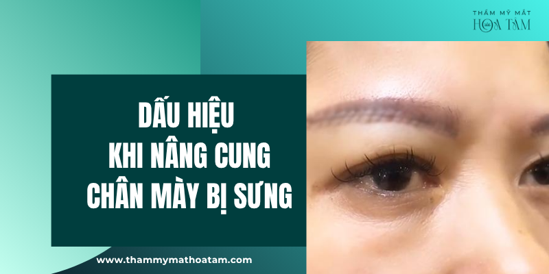 Dấu hiệu rõ nhất khi nâng cung chân mày bị sưng