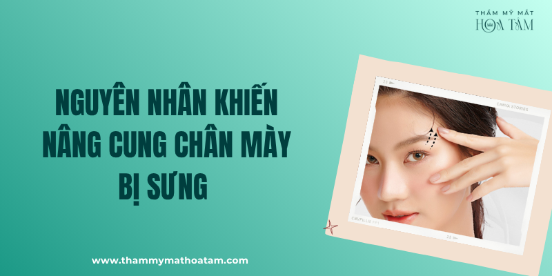 Nguyên nhân gây ra tình trạng nâng cung mày bị sưng