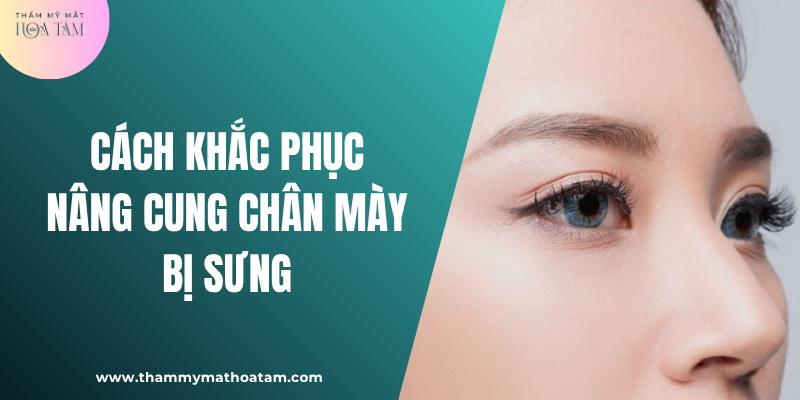 Bật mí cách khắc phục nâng cung chân mày bị sưng