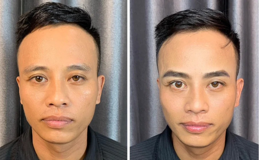 Tìm hiểu về lông mày rậm