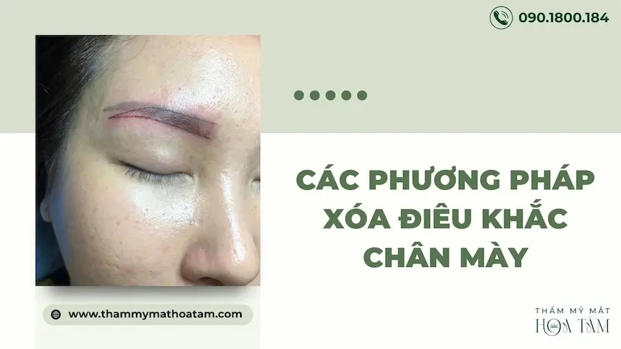 Các phương pháp xóa điêu khắc chân mày hỏng