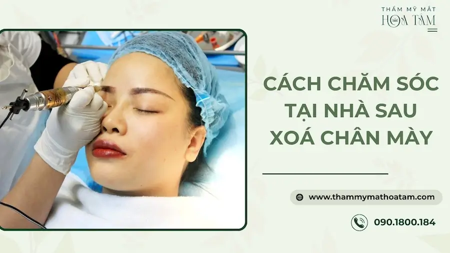 Hướng dẫn kiêng cữ đúng cách để da phục hồi nhanh