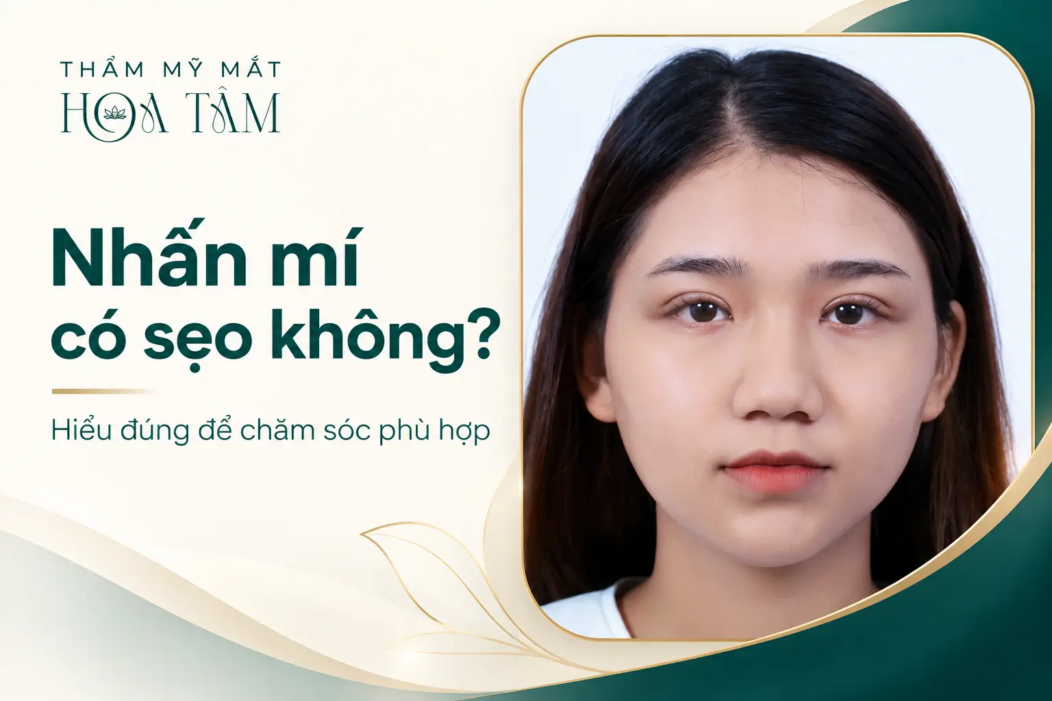 Nhấn mí có để lại sẹo không? Nhấn mí có để lại sẹo không?
