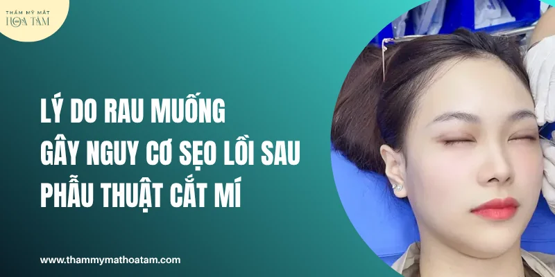 Lý do rau muống lại gây nguy cơ sẹo lồi sau khi phẫu thuật cắt mí