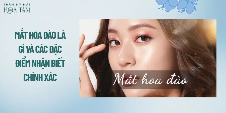 Mắt hoa đào là gì và các đặc điểm nhận biết chính xác