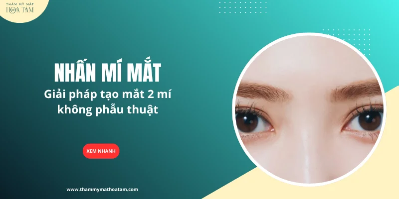 Nhấn mí mắt – Giải pháp tạo mắt 2 mí không phẫu thuật