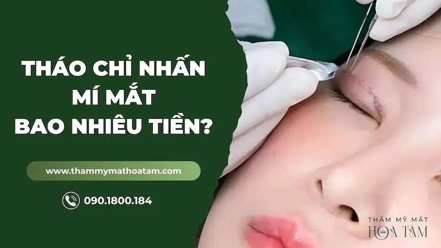 Bảng giá tháo chỉ nhấn mí mắt cơ bản