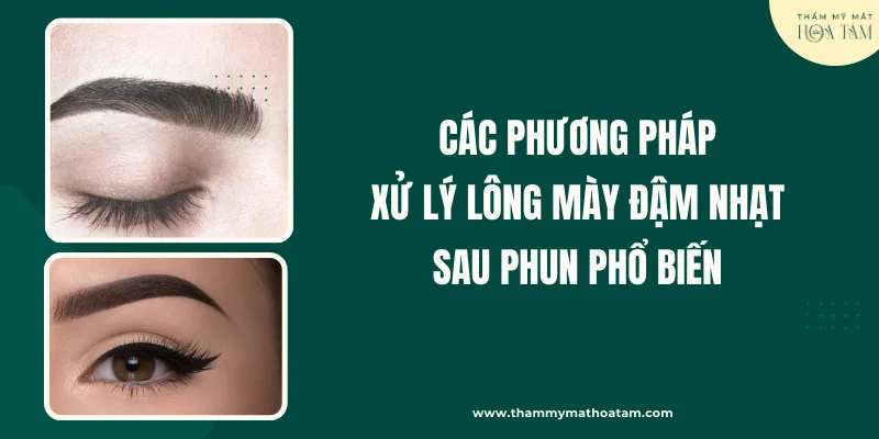 Các phương pháp xử lý lông mày đậm nhạt sau phun phổ biến hiện nay