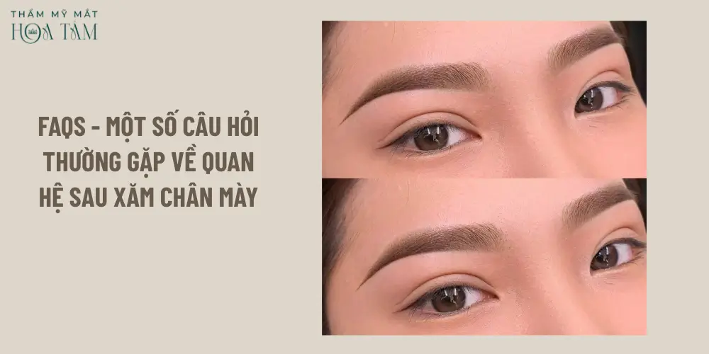 FAQs - Một số câu hỏi thường gặp về quan hệ sau xăm chân mày