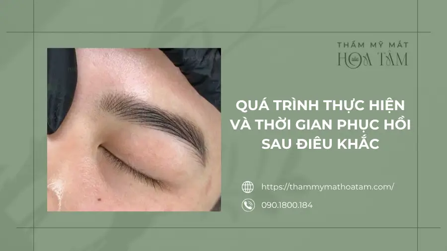 Quá trình thực hiện và thời gian phục hồi sau điêu khắc