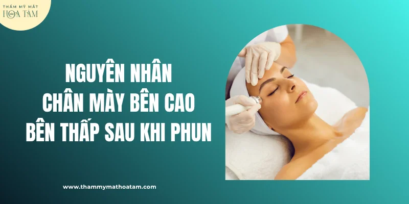 Nguyên nhân chân mày bên cao bên thấp sau khi phun