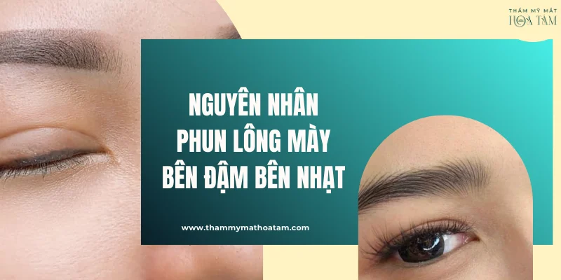 Nguyên nhân dẫn tới hiện tượng phun lông mày bên đậm bên nhạt