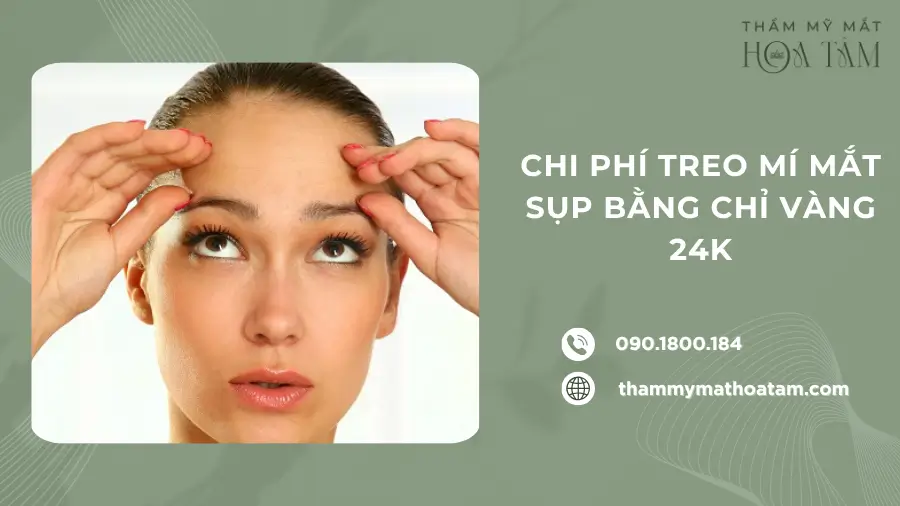 Chi phí treo mí mắt sụp bằng chỉ vàng