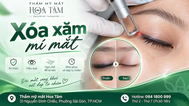 Xóa xăm mí mắt: Phương pháp, quy trình, chi phí, rủi ro