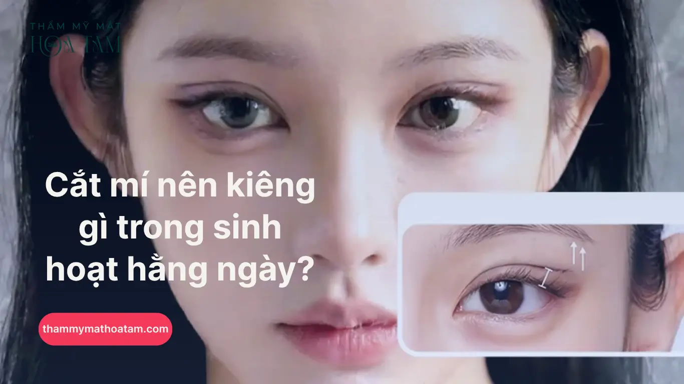 Cắt mí nên kiêng gì trong sinh hoạt hằng ngày?