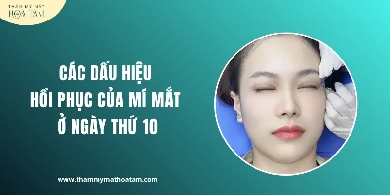 Các dấu hiệu hồi phục của mí mắt ở ngày thứ 10