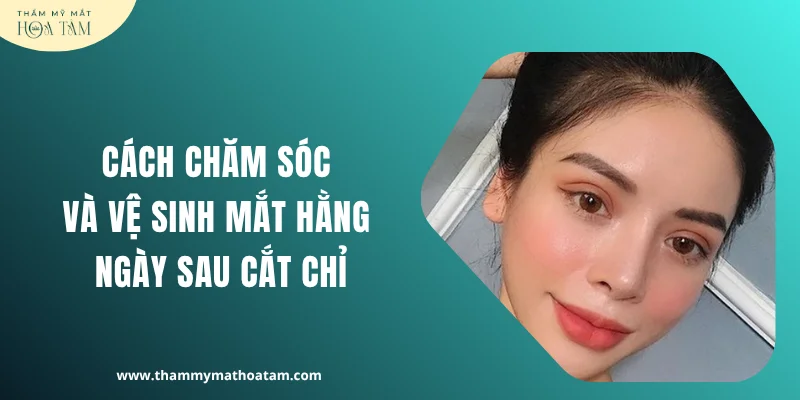 Cách chăm sóc và vệ sinh mắt hằng ngày sau khi cắt chỉ