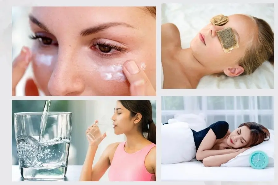 cải thiện quầng thâm mắt đơn giản tại nhà