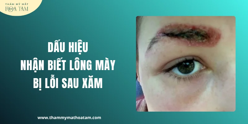 Dấu hiệu nhận biết lông mày bị lỗi sau phun xăm 