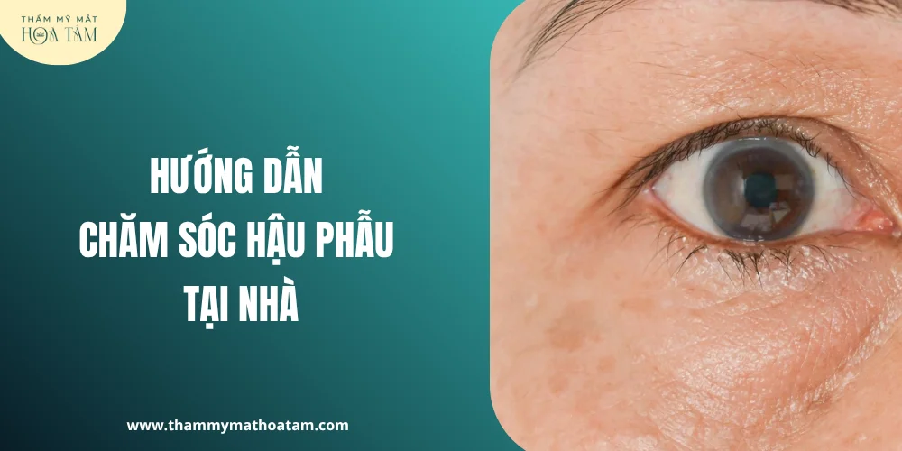 Hướng dẫn chăm sóc hậu phẫu tại nhà