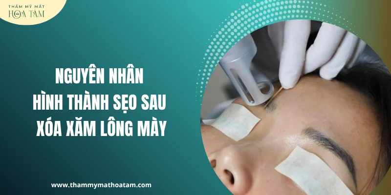 Nguyên nhân hình thành sẹo sau xóa xăm lông mày