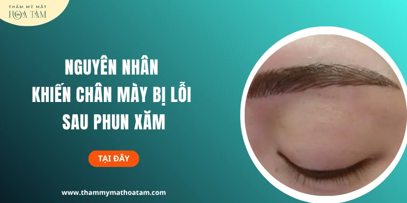 Nguyên nhân khiến chân mày bị lỗi sau phun xăm