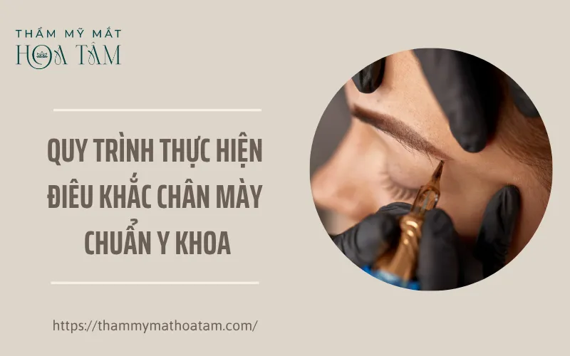 Quy trình thực hiện điêu khắc chân mày chuẩn y khoa