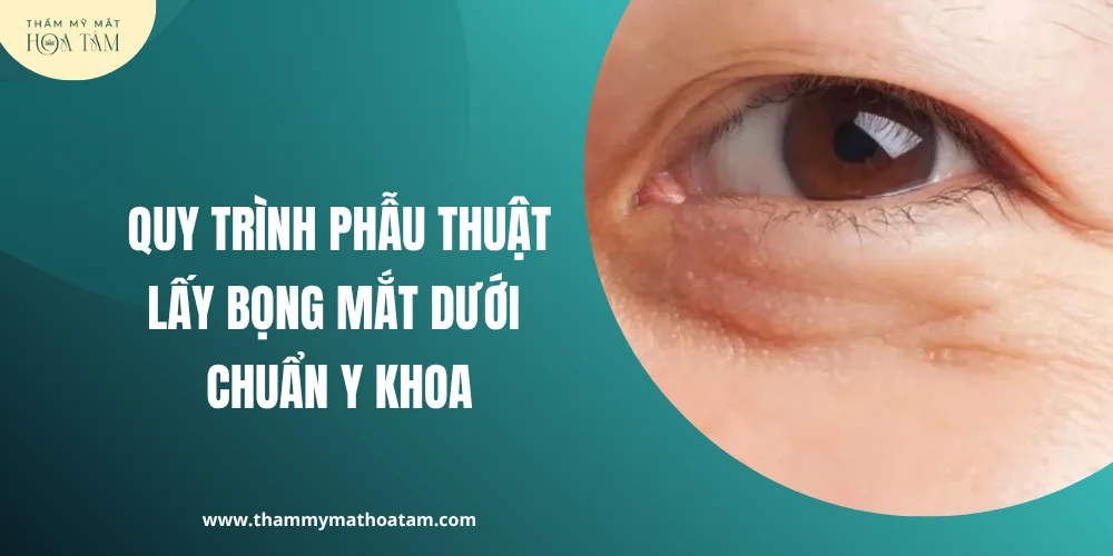 Quy trình phẫu thuật lấy bọng mắt dưới chuẩn y khoa