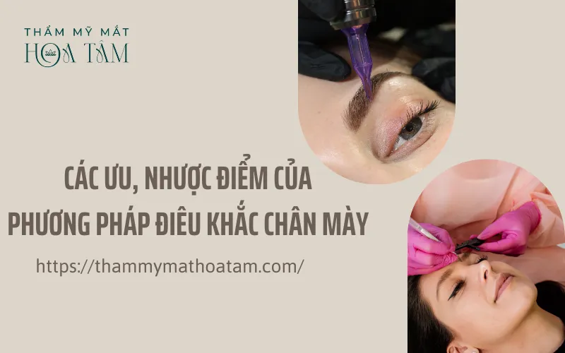 Các ưu, nhược điểm của phương pháp điêu khắc chân mày