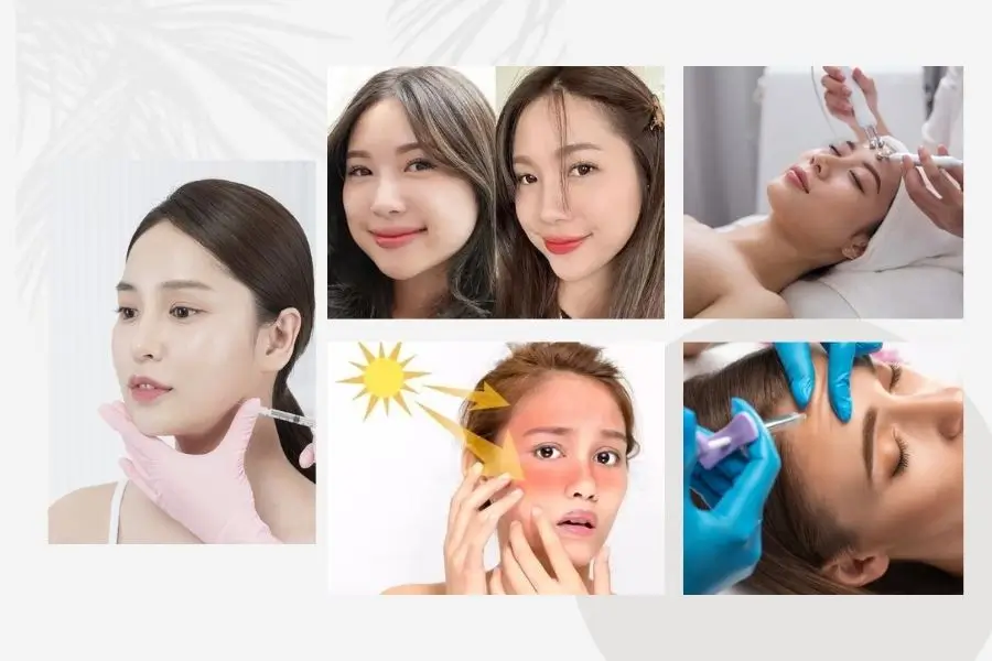 Thói quen bảo vệ da sau khi tiêm botox cần lưu ý