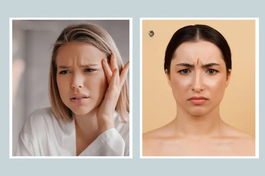 Các vấn đề hay gặp giữa hai lông mày gọi là gì