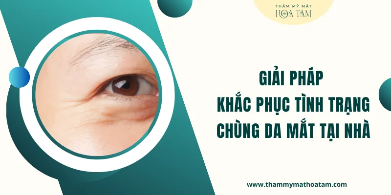 Giải pháp khắc phục tình trạng chùng da mắt tại nhà