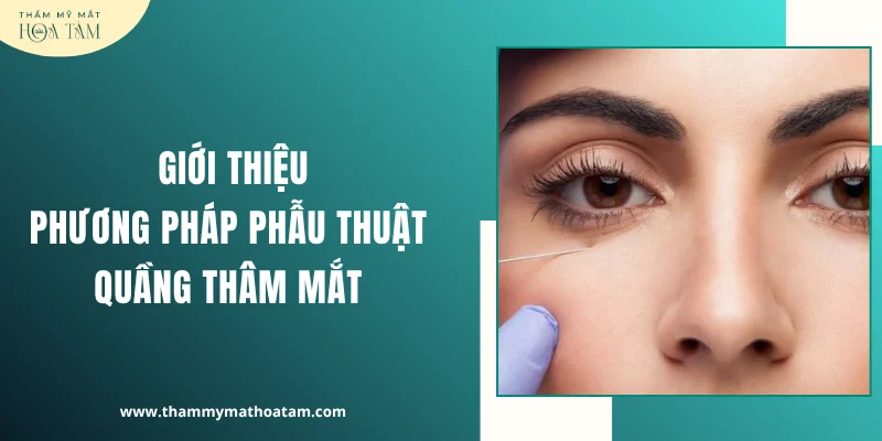 Giới thiệu phương pháp phẫu thuật quầng thâm mắt Giới thiệu phương pháp phẫu thuật quầng thâm mắt