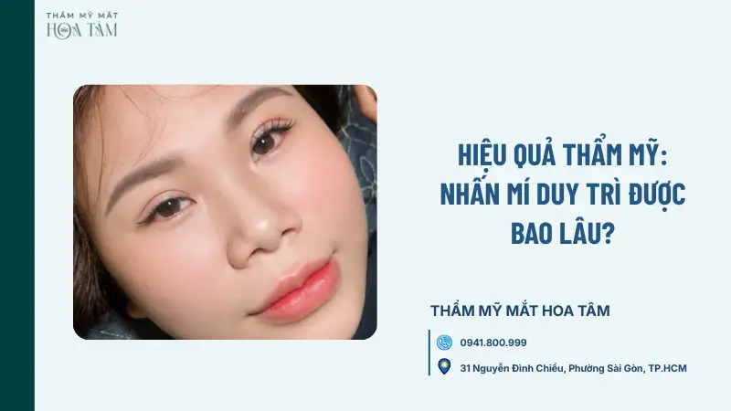 Hiệu quả thẩm mỹ: Nhấn mí duy trì được bao lâu?