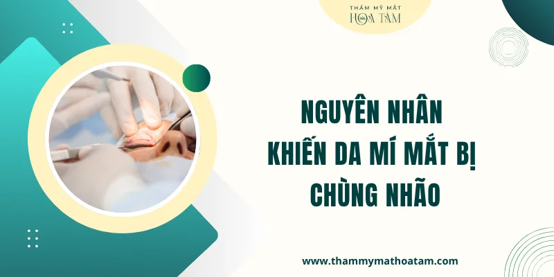Nguyên nhân khiến da mí mắt bị chùng nhão