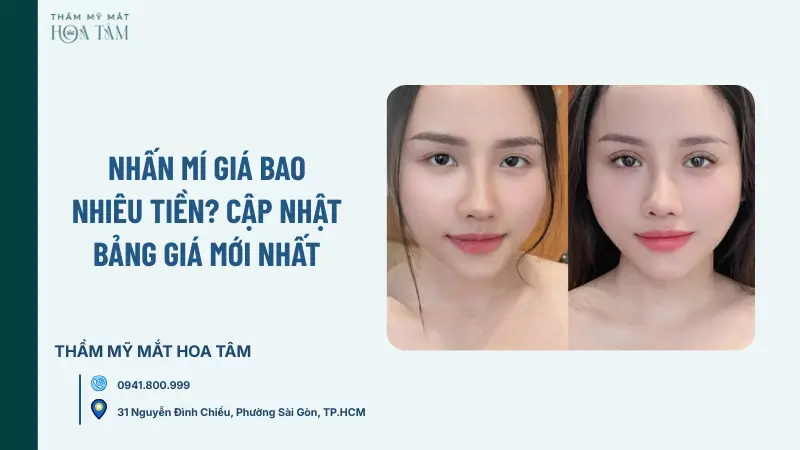 Nhấn mí giá bao nhiêu tiền? Cập nhật bảng giá mới nhất