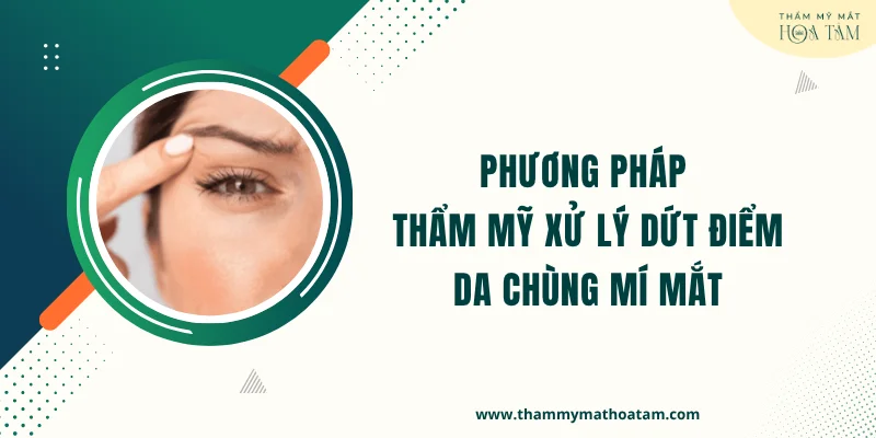 Phương pháp can thiệp thẩm mỹ xử lý dứt điểm da chùng mí mắt