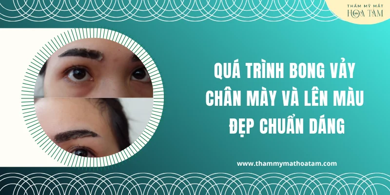 Quá trình bong vảy chân mày và lên màu đẹp chuẩn dáng