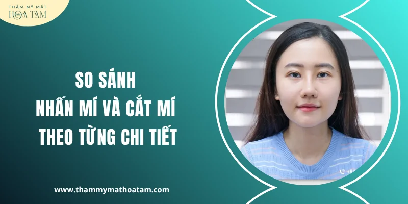 So sánh nhấn mí và cắt mí theo từng chi tiết
