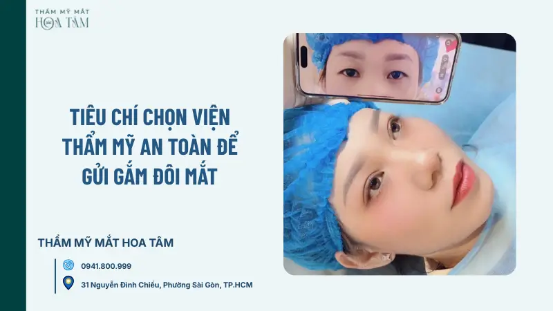 Tiêu chí chọn viện thẩm mỹ an toàn để gửi gắm đôi mắt