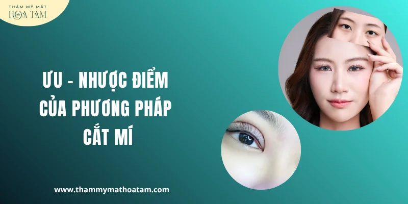 Ưu - Nhược điểm của tiểu phẫu cắt mí mắt