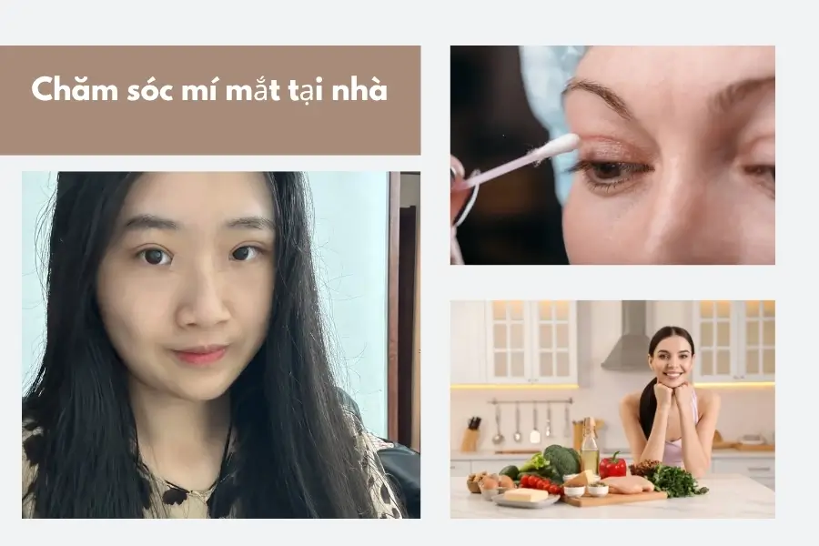 Chăm sóc và bổ sung dinh dưỡng sau quá trình cắt mí mắt