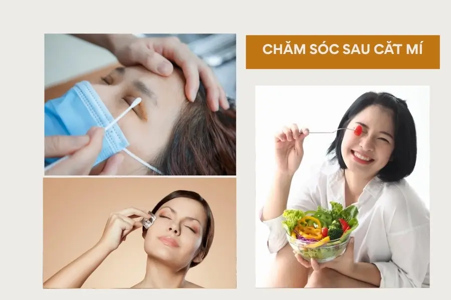 Chăm sóc sau cắt mí size 7 an toàn tại nhà