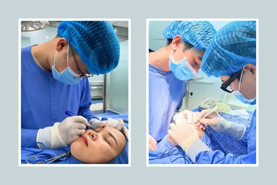 Đo vẽ, gây tê trong quá trình cắt mí mắt